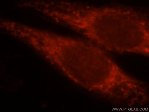 [17827-1-AP-150UL] RAB3IL1 Polyclonal antibody