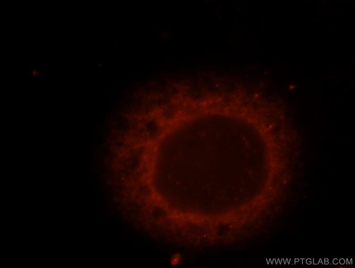 [17831-1-AP-150UL] TNPO2 Polyclonal antibody