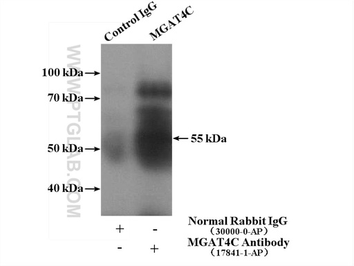 [17841-1-AP-150UL] MGAT4C Polyclonal antibody