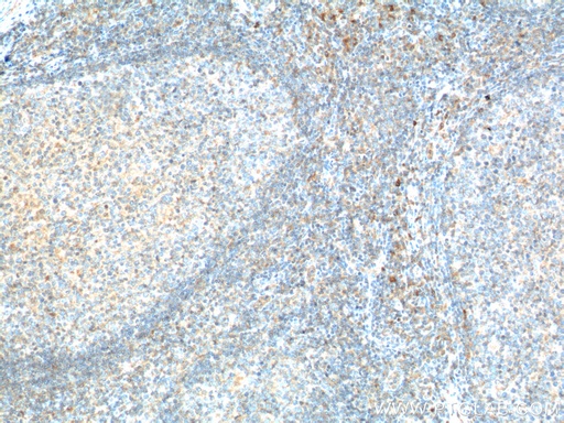 [17842-1-AP-20UL] CD226 Polyclonal antibody