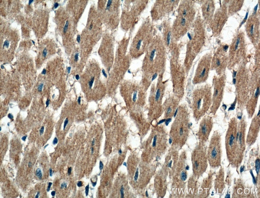 [17843-1-AP-150UL] P2RX3 Polyclonal antibody