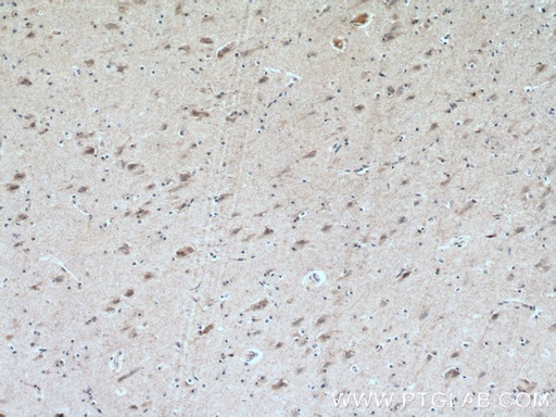 [17844-1-AP-20UL] CHRNB2 Polyclonal antibody