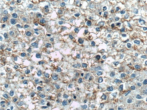 [17852-1-AP-150UL] TNFSF8 Polyclonal antibody