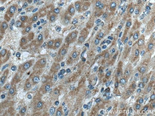 [17854-1-AP-150UL] RFTN2 Polyclonal antibody