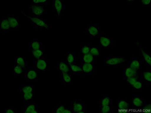 [17856-1-AP-150UL] USP21 Polyclonal antibody