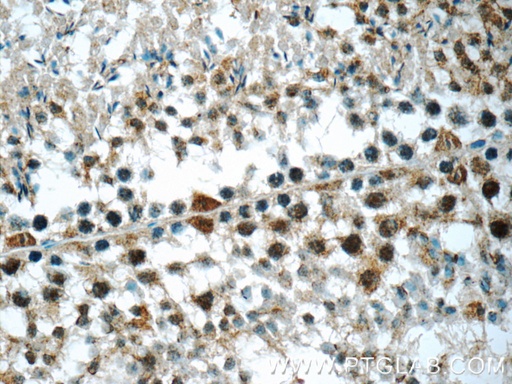 [17857-1-AP-150UL] DDX10 Polyclonal antibody