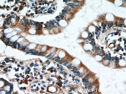 [17859-1-AP-20UL] GCS1 Polyclonal antibody