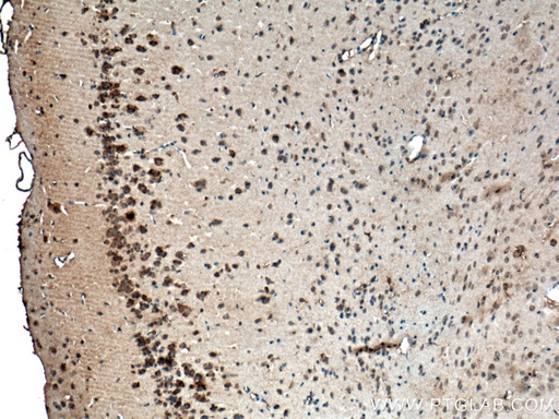 [17862-1-AP-150UL] CACNG7 Polyclonal antibody