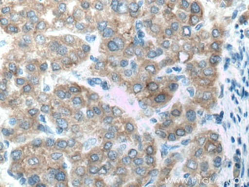 [17868-1-AP-20UL] CYP2D6/7 Polyclonal antibody