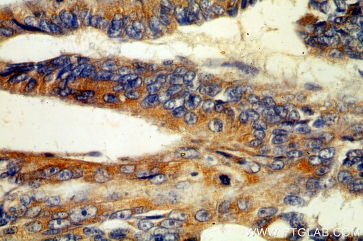 [17869-1-AP-20UL] MGAT3 Polyclonal antibody