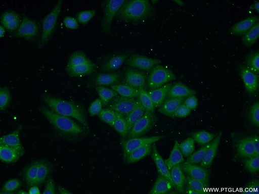 [17872-1-AP-150UL] TP53INP1 Polyclonal antibody