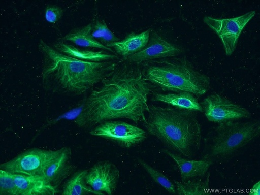 [17873-1-AP-150UL] MMP3 Polyclonal antibody