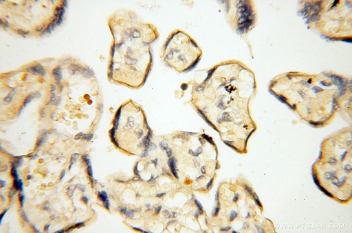 [17874-1-AP-150UL] MMP8 Polyclonal antibody