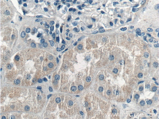 [17877-1-AP-20UL] LMAN2L Polyclonal antibody