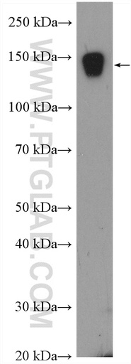 [17878-1-AP-150UL] MMRN1 Polyclonal antibody