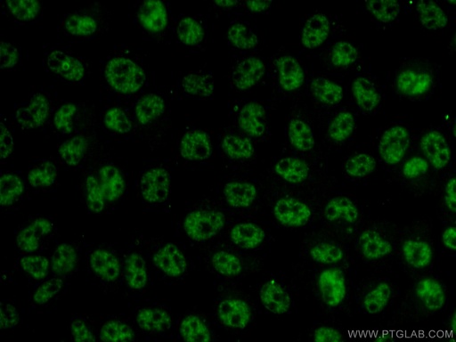 [17881-1-AP-20UL] THOC7 Polyclonal antibody