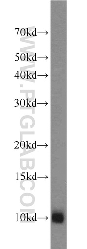 [17884-1-AP-20UL] MPV17L Polyclonal antibody