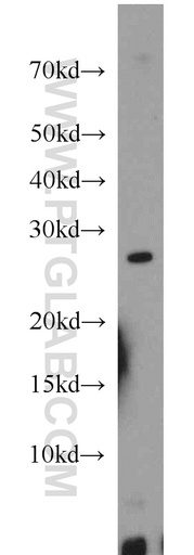 [17888-1-AP-150UL] MXD1 Polyclonal antibody