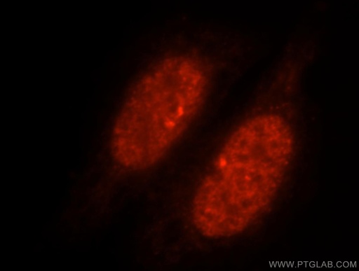 [17889-1-AP-20UL] SLTM Polyclonal antibody