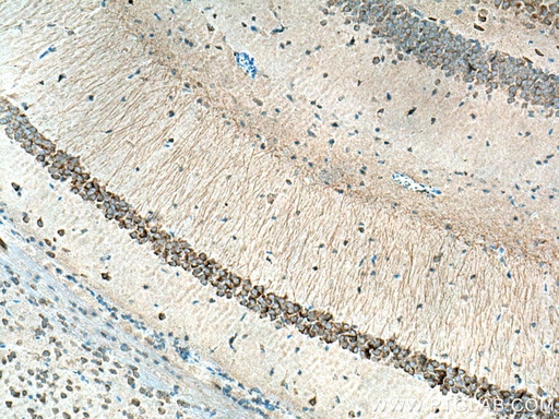 [17890-1-AP-150UL] KCNAB2 Polyclonal antibody