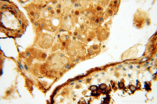 [17893-1-AP-150UL] CTTNBP2 Polyclonal antibody