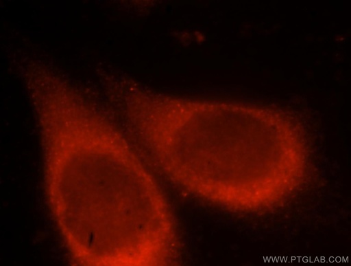 [17894-1-AP-150UL] VPS15 Polyclonal antibody