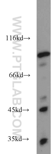 [17897-1-AP-20UL] Opticin Polyclonal antibody