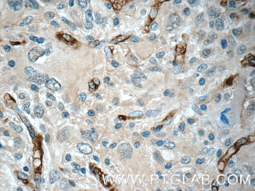 [17903-1-AP-20UL] GAS1 Polyclonal antibody