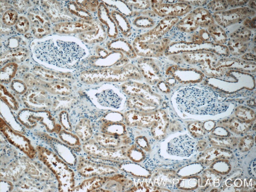 [17908-1-AP-20UL] EPO Polyclonal antibody