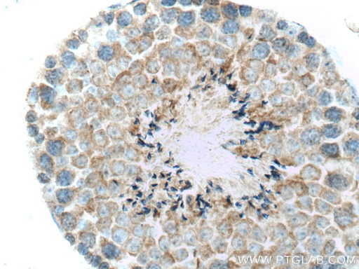[17909-1-AP-20UL] FAAH Polyclonal antibody