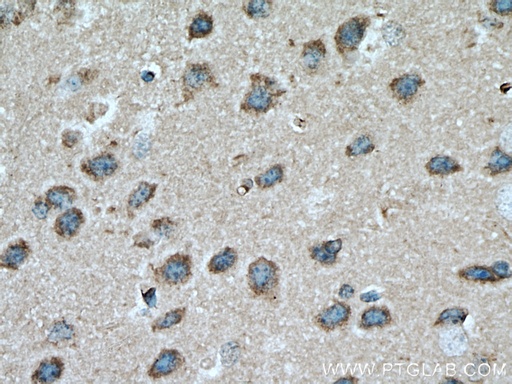 [17911-1-AP-20UL] ADPRH Polyclonal antibody