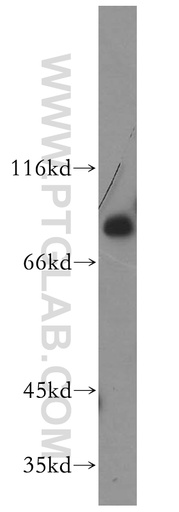 [17914-1-AP-20UL] MDMX Polyclonal antibody