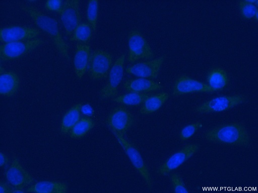 [17917-1-AP-20UL] EIF4B Polyclonal antibody