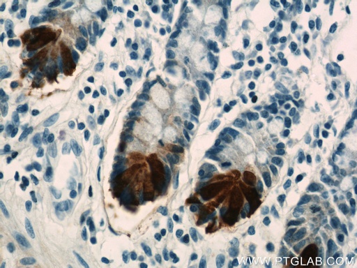[17923-1-AP-150UL] DEFA6 Polyclonal antibody