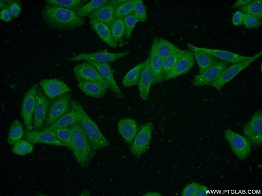 [17924-1-AP-150UL] S100A5 Polyclonal antibody