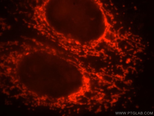 [17925-1-AP-20UL] ETFB Polyclonal antibody