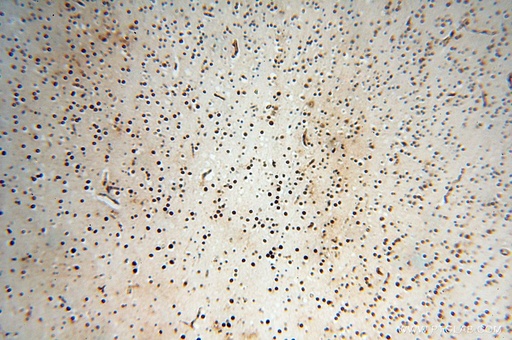 [17927-1-AP-150UL] HESX1 Polyclonal antibody