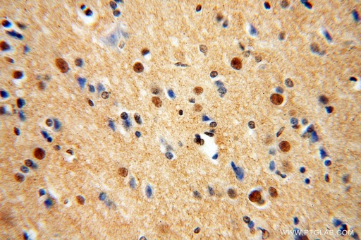 [17928-1-AP-150UL] TUB Polyclonal antibody