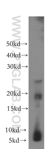 [17931-1-AP-20UL] CRYGC Polyclonal antibody