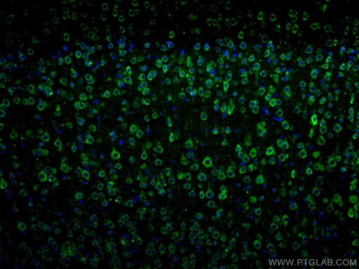 [17934-1-AP-150UL] DRD1 Polyclonal antibody