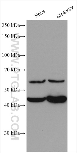[17937-1-AP-20UL] PTPRR Polyclonal antibody