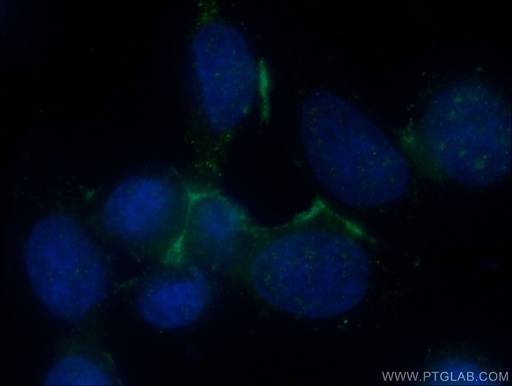 [17938-1-AP-150UL] Galectin-9 Polyclonal antibody
