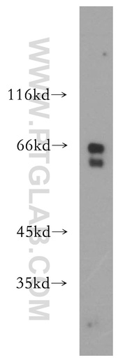 [17939-1-AP-20UL] RPE65 Polyclonal antibody