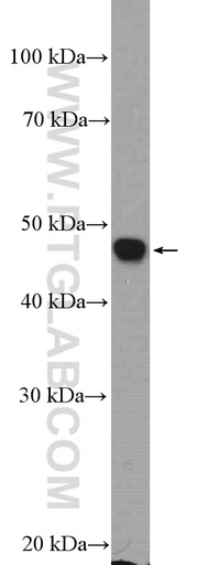 [17942-1-AP-150UL] Neurokinin-1 receptor Polyclonal antibody