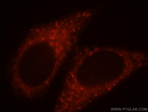 [17948-1-AP-20UL] PRR5 Polyclonal antibody