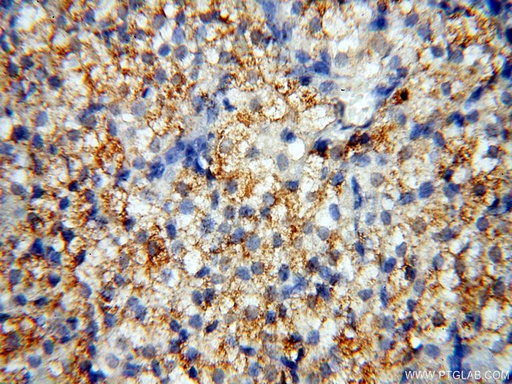 [17950-1-AP-20UL] GPR177 Polyclonal antibody
