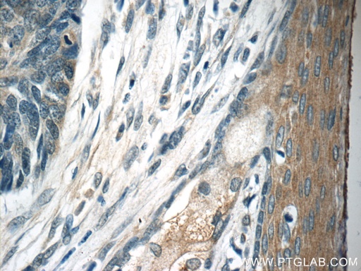 [17953-1-AP-20UL] TMPRSS3 Polyclonal antibody