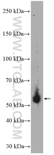 [17954-1-AP-150UL] HFE Polyclonal antibody