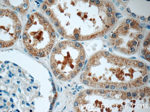 [17955-1-AP-20UL] SRR Polyclonal antibody