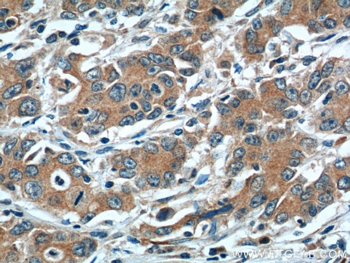 [17958-1-AP-20UL] LOX Polyclonal antibody